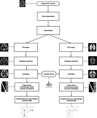 Comparing CAT12 and VBM8 for Detecting Brain Morphological Abnormalities in Temporal Lobe Epilepsy